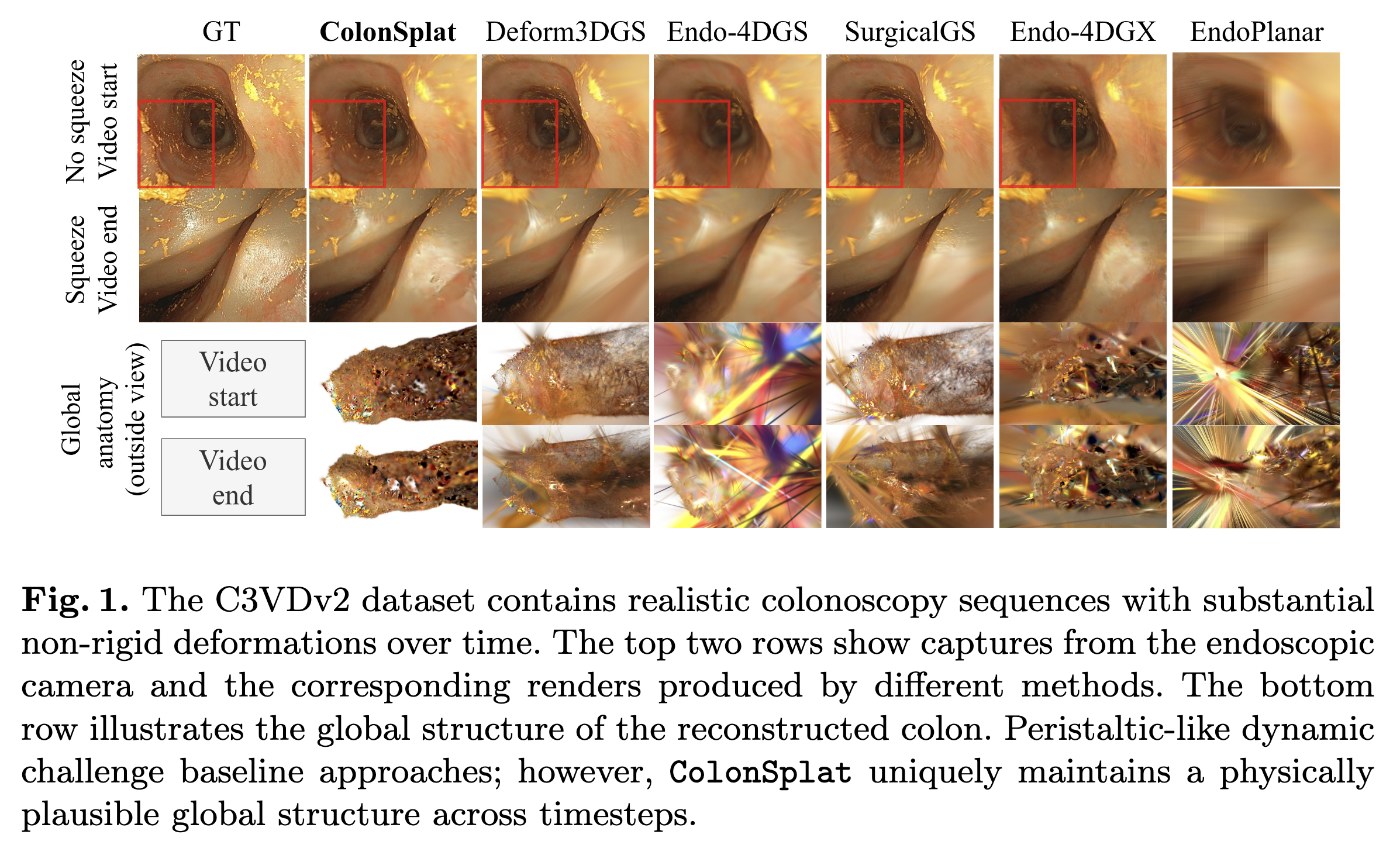 ColonSplat overview figure